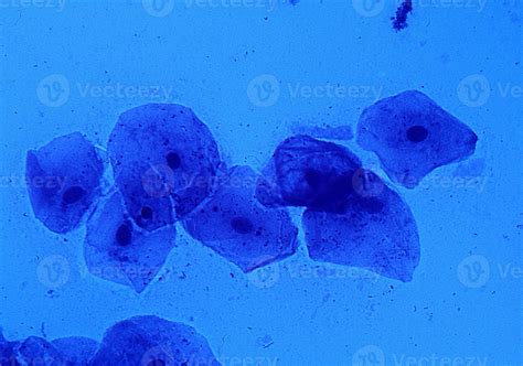 Cheek Cell 400x Magnification