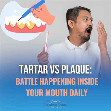 Tartar vs Plaque: Battle Happening Inside Your Mouth Daily