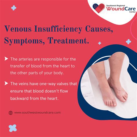 Pots And Venous Insufficiency at Brianna Rocher blog