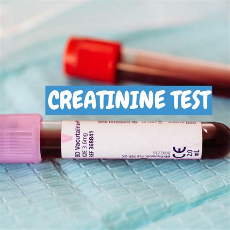 Image result for Creatinine Lab Testing