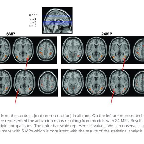 Image result for Define Localizer