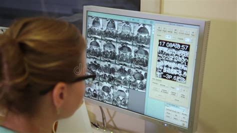 Image result for Cat Computerized Axial Tomography Machine