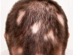 Dermatology articles page [12] | MedPage Today