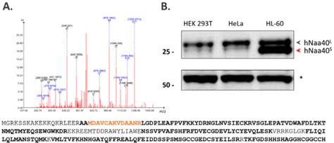 N-Terminal Acetyltransferase Naa40p Whereabouts Put into N-Terminal ...