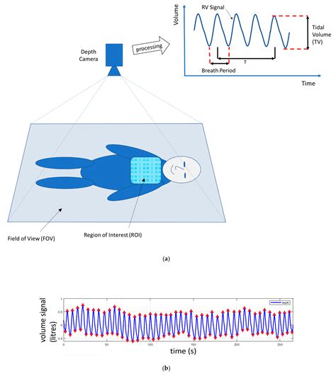 Noncontact Respiratory Monitoring Using Depth Sensing Cameras: A Review ...