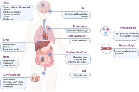 How Do The Lungs Of Adenosine Deaminase Deficiency Patients Actually Repair Damage
