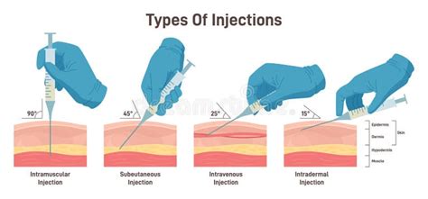 Image result for All Types of Injection