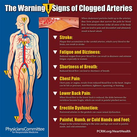 The Warning Signs of Clogged Arteries | Heart blockage, Clogged arteries, Arteries
