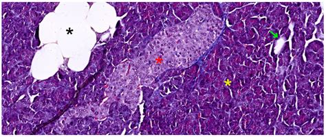 Pancreatic Morphology, Immunology, and the Pathogenesis of Acute ...