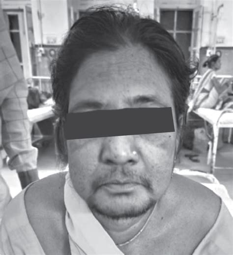 Latest Clinical Journal | Reviews | Medical Research | Guidelines | IJCP