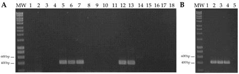 Sweet Potato Symptomless Virus 1: First Detection in Europe and ...