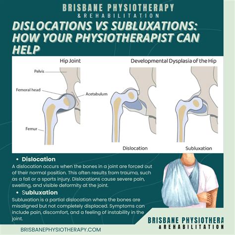 Dislocations vs. Subluxations - What's the difference? - Brisbane ...