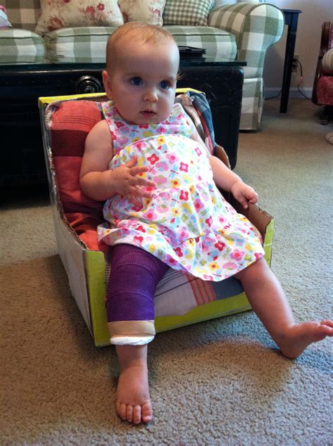 Spica Cast Hip Dysplasia