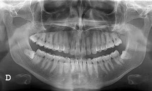 Image result for RADIOGRAPHY