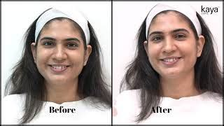 Kaya - Skin and Hair Care Services, Treatments & Products in India