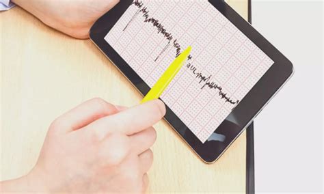 Easy-to-use ECG algorithm can predict coronary occlusion site in STEMI ...
