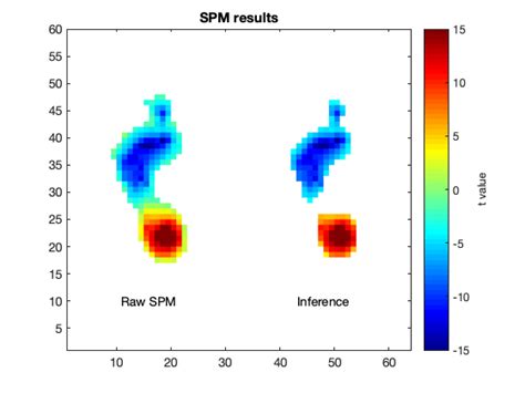 Image result for MATLAB SPM Model Analysis