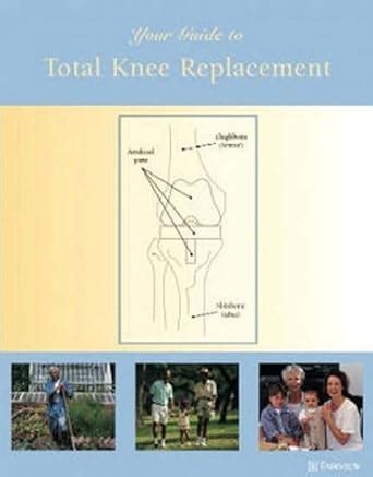 Buy Your Guide to Total Knee Replacement Book Online at Low Prices in ...