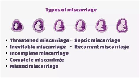 miscarriage | PPTX