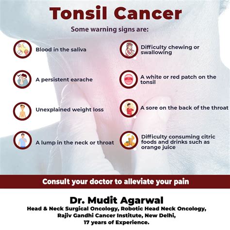 First Stage Tonsil Cancer
