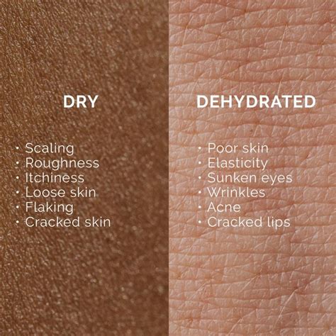 Mary Cohr North America on Instagram: "Do you have dry or dehydrated ...