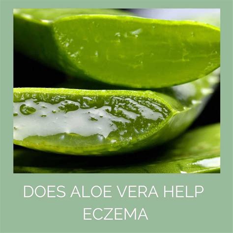 Does Aloe Vera Help Eczema? - Odylique