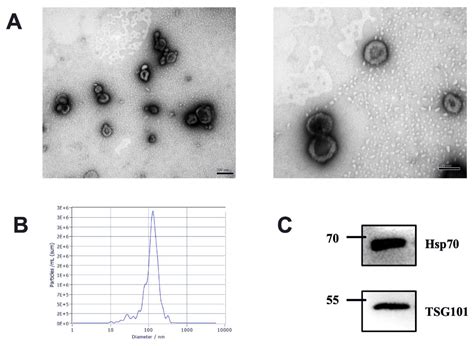 Comparative Proteomic Analysis of Milk-Derived Extracellular Vesicles ...