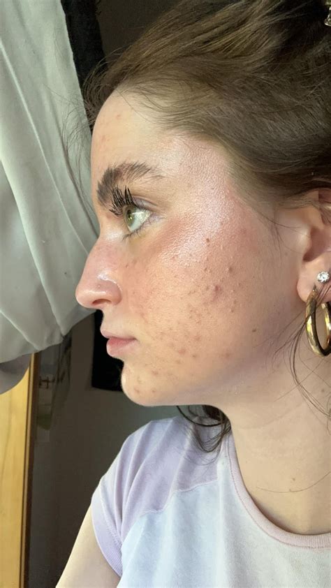 I know my nose is big, does it suit my face? : r/Noses