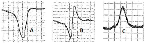 Electrocardiographic Reference Values in Clinically Healthy Lusitano Horses