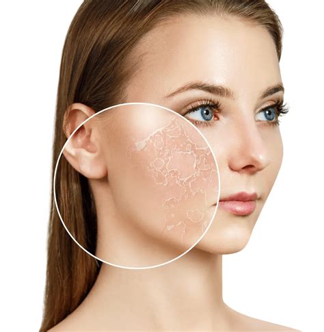 Best Skincare Routine for Dry, Flaky Skin During Winter – Glopetra