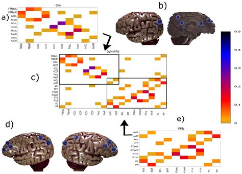 Quantifying the Variability in Resting-State Networks