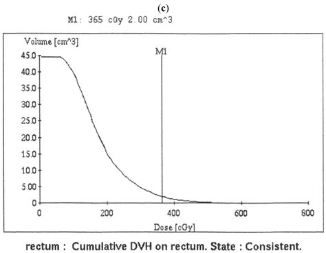 Efficacy and Safety of High-Dose-Rate Brachytherapy of Single Implant ...