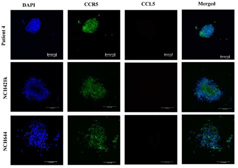 CCR5-Mediated Signaling is Involved in Invasion of Glioblastoma Cells ...