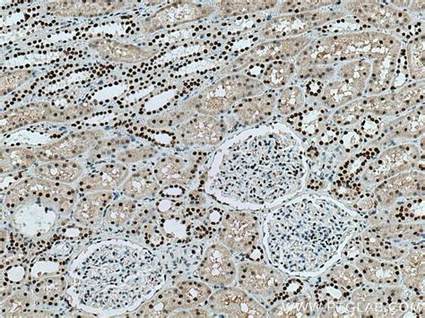 ANP32A antibody (67687-1-Ig) | Proteintech