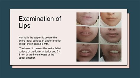General and extra oral examination orthodontics | PPTX
