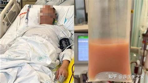 男子路边捡饮料喝中毒进ICU最新素材