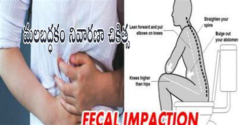 మలబద్ధకము చికిత్స - మలబద్ధకము నివారణ - MegaMinds