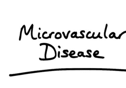 कोरोनरी माइक्रोवास्कुलर डिजीज का क्या होता है कारण, जानिए यहां - हैलो ...