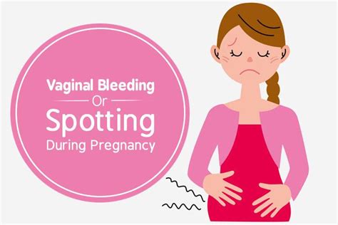How To Stop Vaginal Bleeding Or Spotting During Pregnancy?