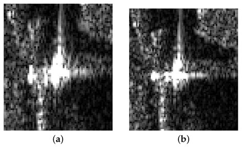 Motion Error Estimation and Compensation of Airborne Array Flexible SAR ...