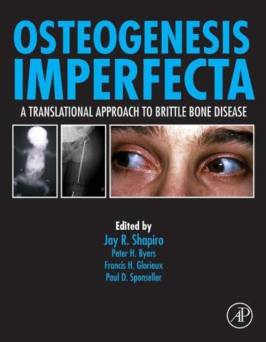 Osteogenesis Imperfecta: A Translational Approach to Brittle Bone ...