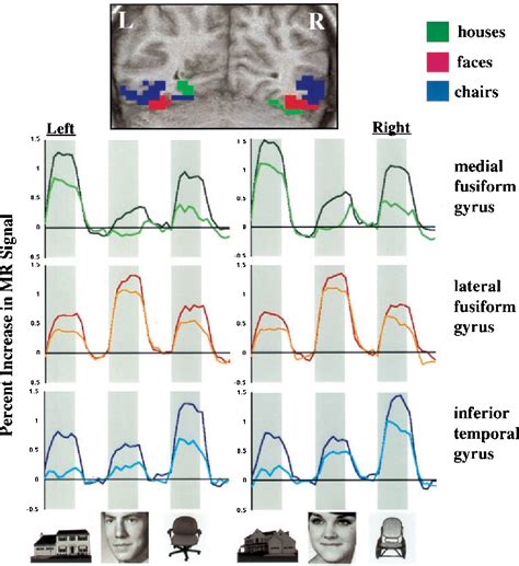 Visual and Auditory Pathways 的图像结果