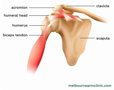 Bicep Tendon Tear | Signs & Symptoms | Melbourne Arm Clinic