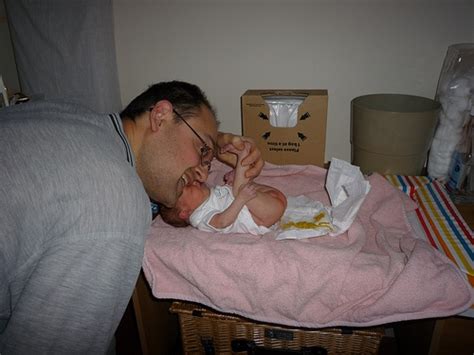 Image result for Diaper Change Problems