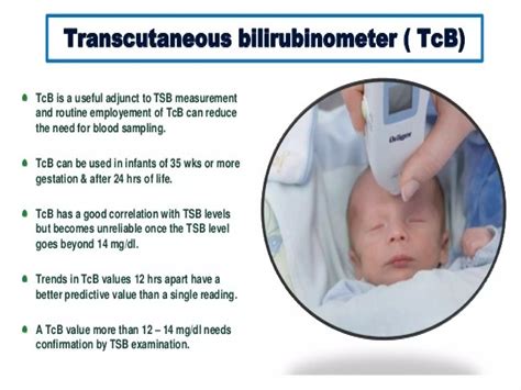 Image result for Neonatal Jaundice Algorithm
