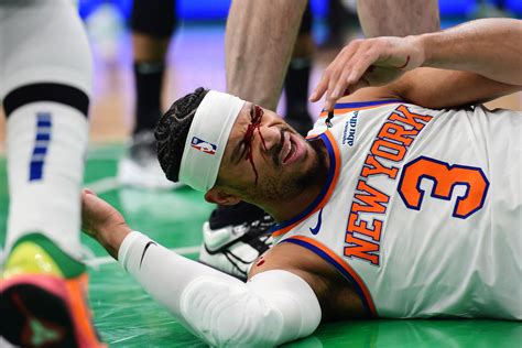 Josh Hart left covered in blood after Luke Kornet smashes him in face ...