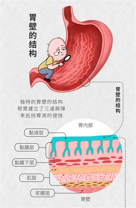 肠画短说：好好的胃，怎么就溃疡了？|胃溃疡|胃黏膜|胃部|-健康界