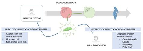 Role of Mitochondria Transfer in Infertility: A Commentary