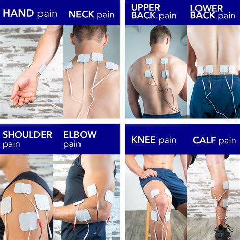 Pin by Jessica Beaty on Tens unit | Tens unit placement, Ten unit, Tens ...