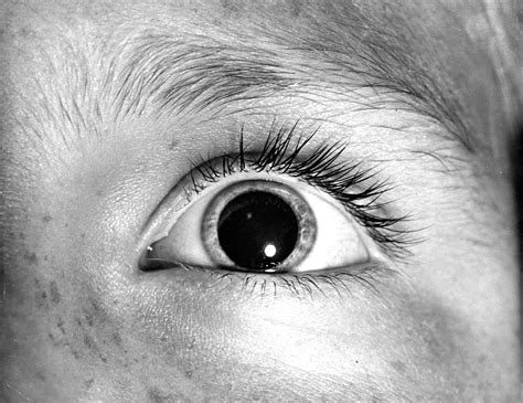 What Does It Mean When Your Dogs Pupils Are Dilated